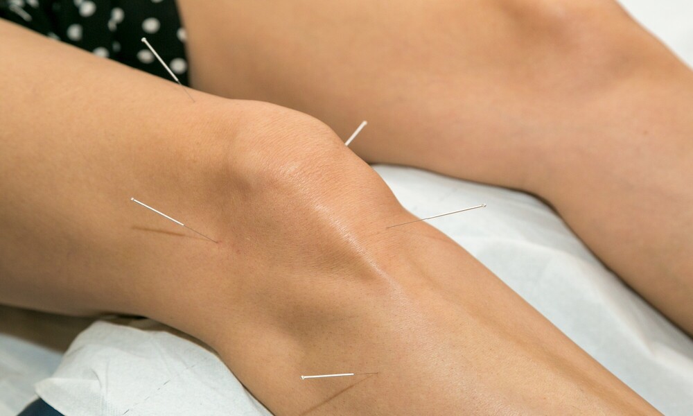 Acupuncture for knee disorder